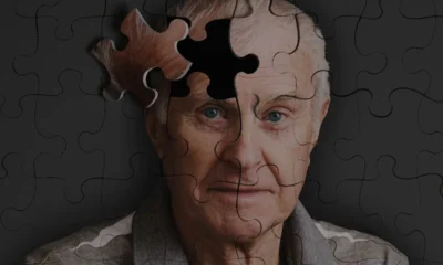 Alzheimer Teşhisinde 7 Yıl Erken Tespit Mümkün