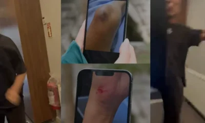 Göktürk'te spor salonunda kira kavgası şiddetle bitti