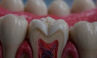 Toregem BioPharma Diş Çıkartma Tedavisinde Faz 2a Aşamasında