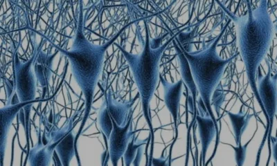 Beyin Gen Haritası Çıkarıldı Alzheimer ve Parkinson İçin Ortak Genler Bulundu