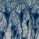 Beyin Gen Haritası Çıkarıldı Alzheimer ve Parkinson İçin Ortak Genler Bulundu